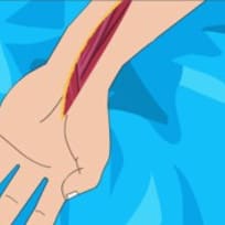 Operate Now: Chirurgie du Bras