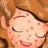 Sofia Squeeze Pimples